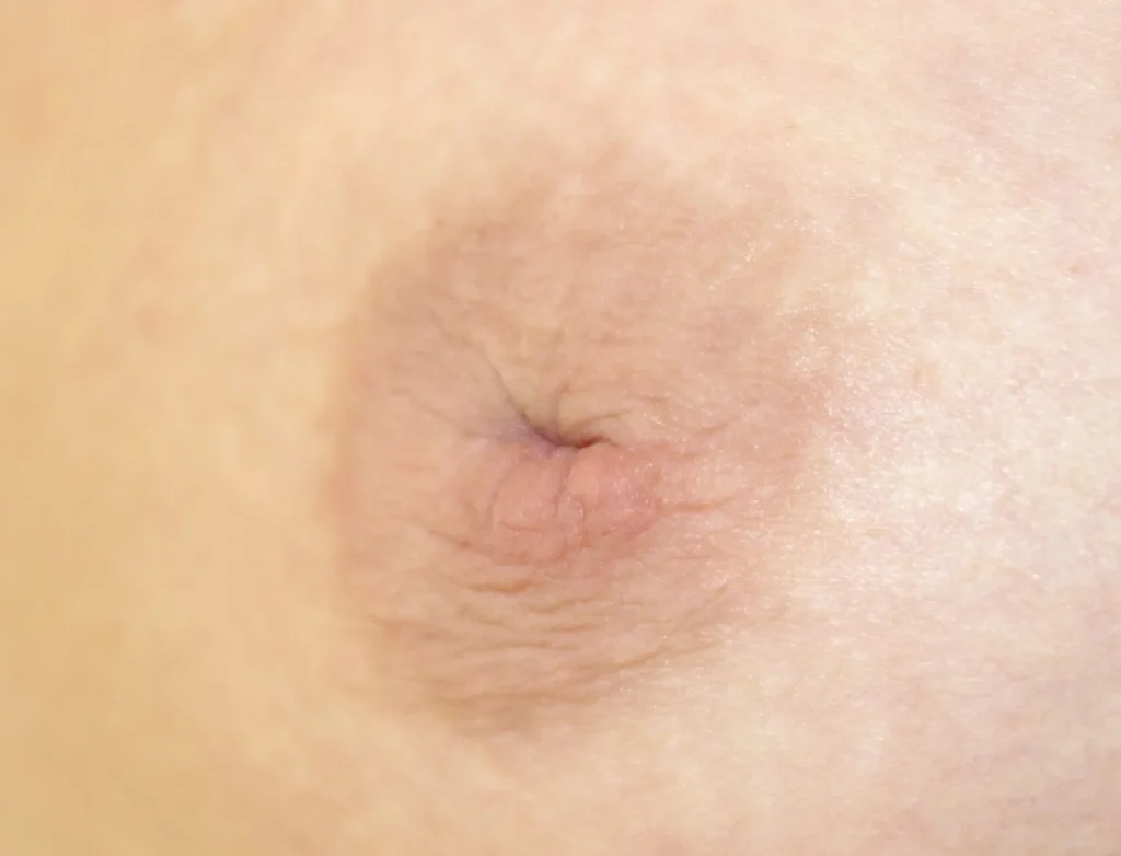 foto-pezon-invertido