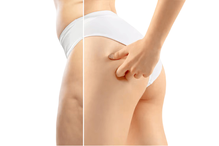 lifting muslos sevilla (1)