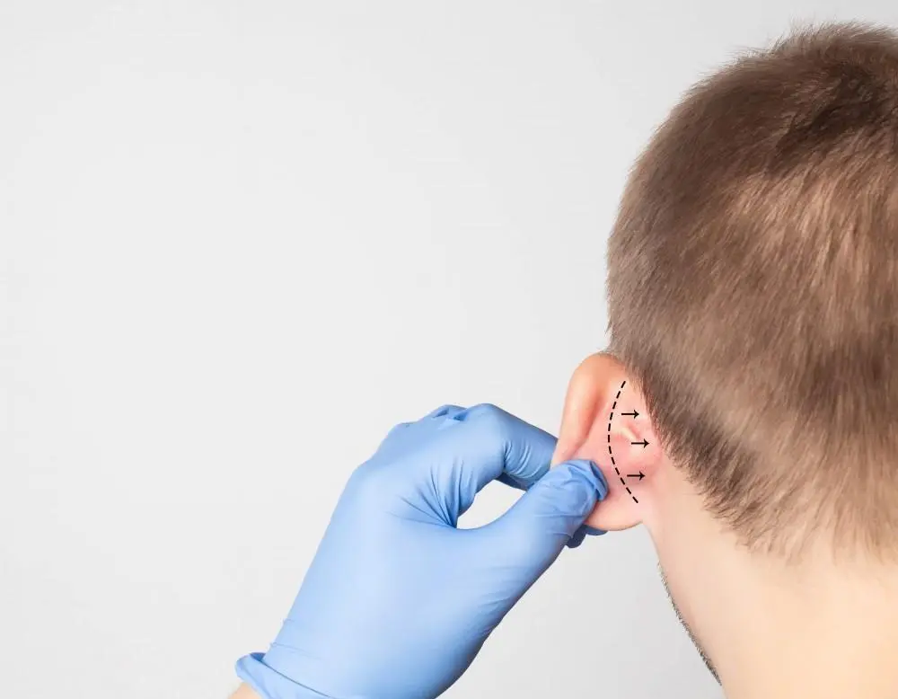 tratamientos-faciales-en-sevilla-otoplastia